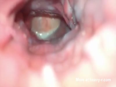 Internal Vagina Cam - Octopus Inside Girls Vagina Videos - Free Porn Videos