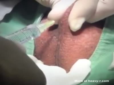 Scary Castration Video