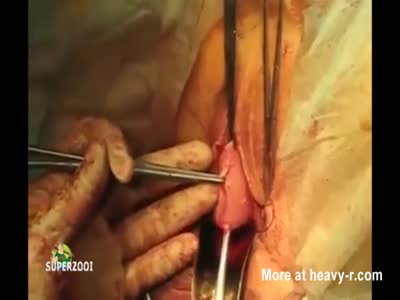 Pussy Surgery Porn - Bloody Pussy Surgery